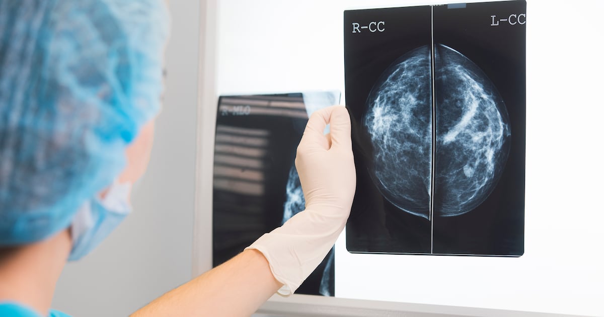 Estudo de longo prazo associa diabetes tipo 2 ao câncer - com mulheres enfrentando o dobro do risco