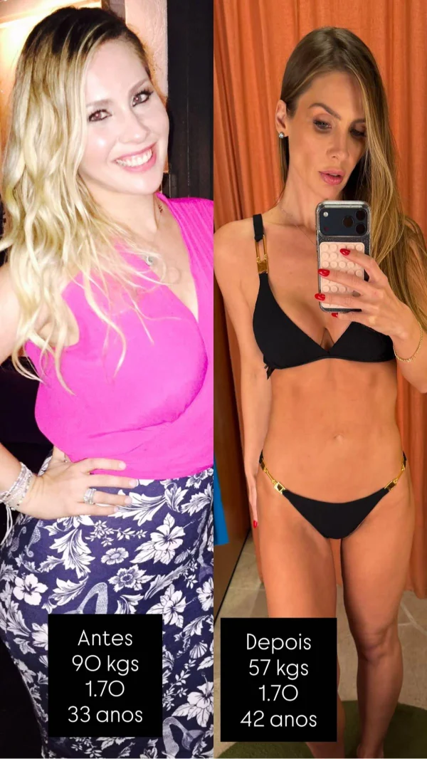 Ex-BBB Ana Carolina Madeira surpreende ao mostrar antes e depois; veja foto