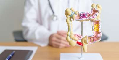 Veja os perigos dos pólipos intestinais Foto: Shutterstock / Saúde em Dia