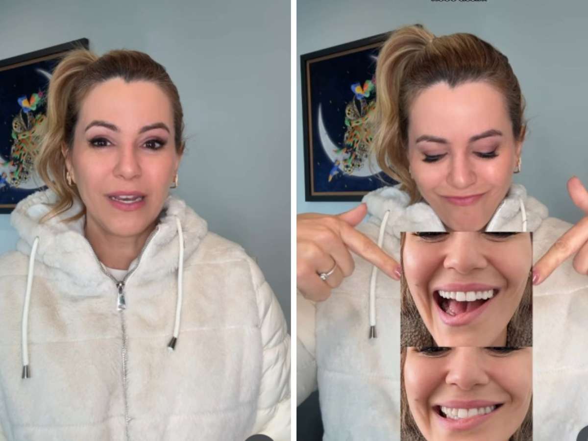 Ex-Panicat Tania Oliveira revela intercorrência em retirada de tumor: 'Meu sorriso ficou comprometido'