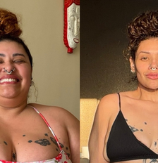 Aila Menezes mostra antes e depois de bariátrica Foto: Reprodução/Instagram