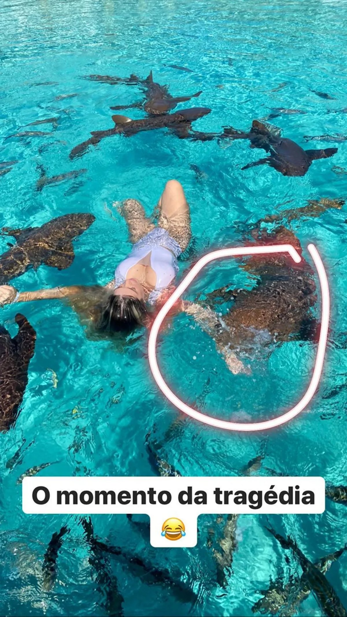 Ana Bruna Ávila mostra mordida de tubarão