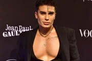 Influencer investe R$ 300 mil em transformação após 20 procedimentos