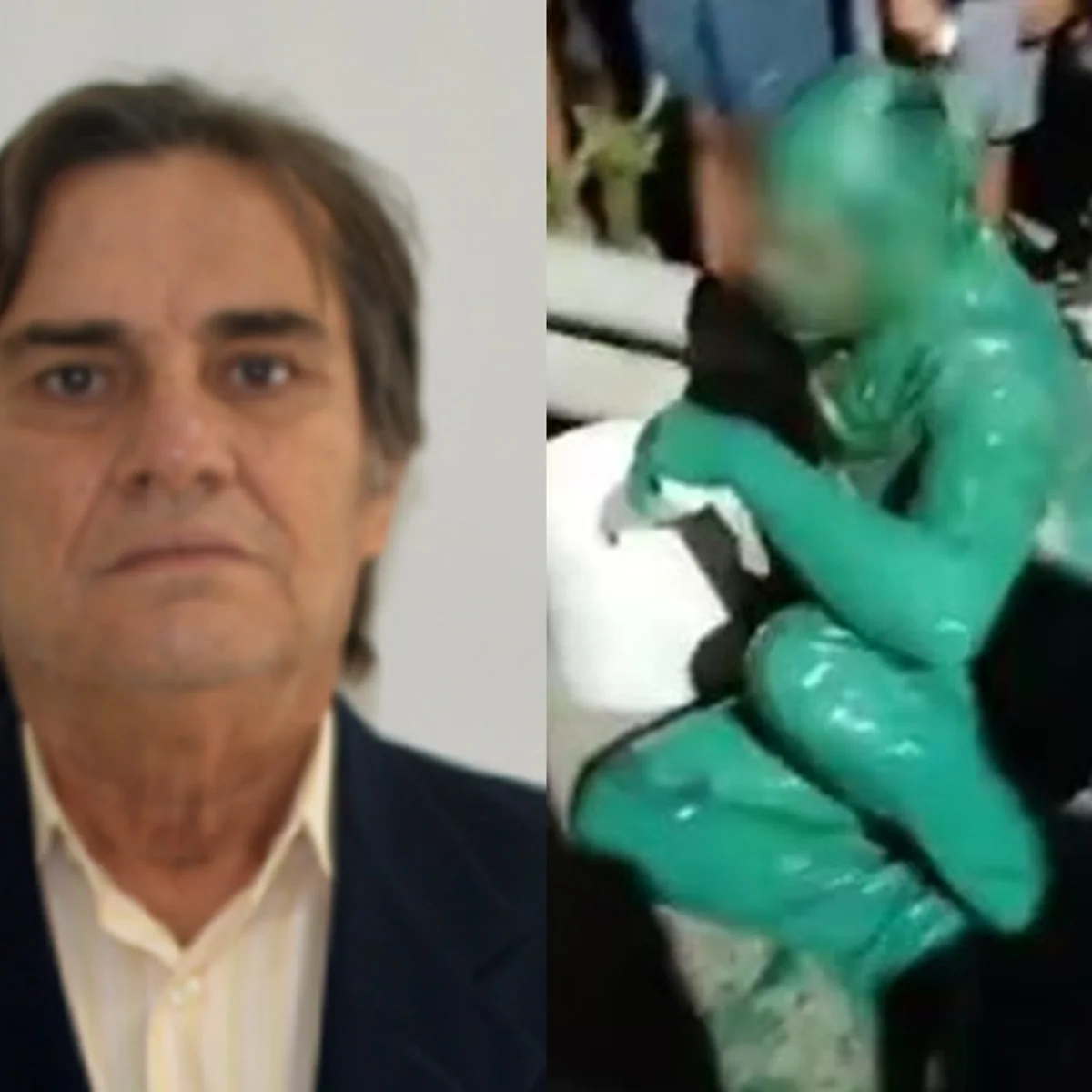 Morre vereador após acidente que deixou "homem pintado de verde" no Ceará