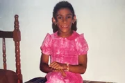 Doença rara faz mulher ter ausência quase total de gordura aparente