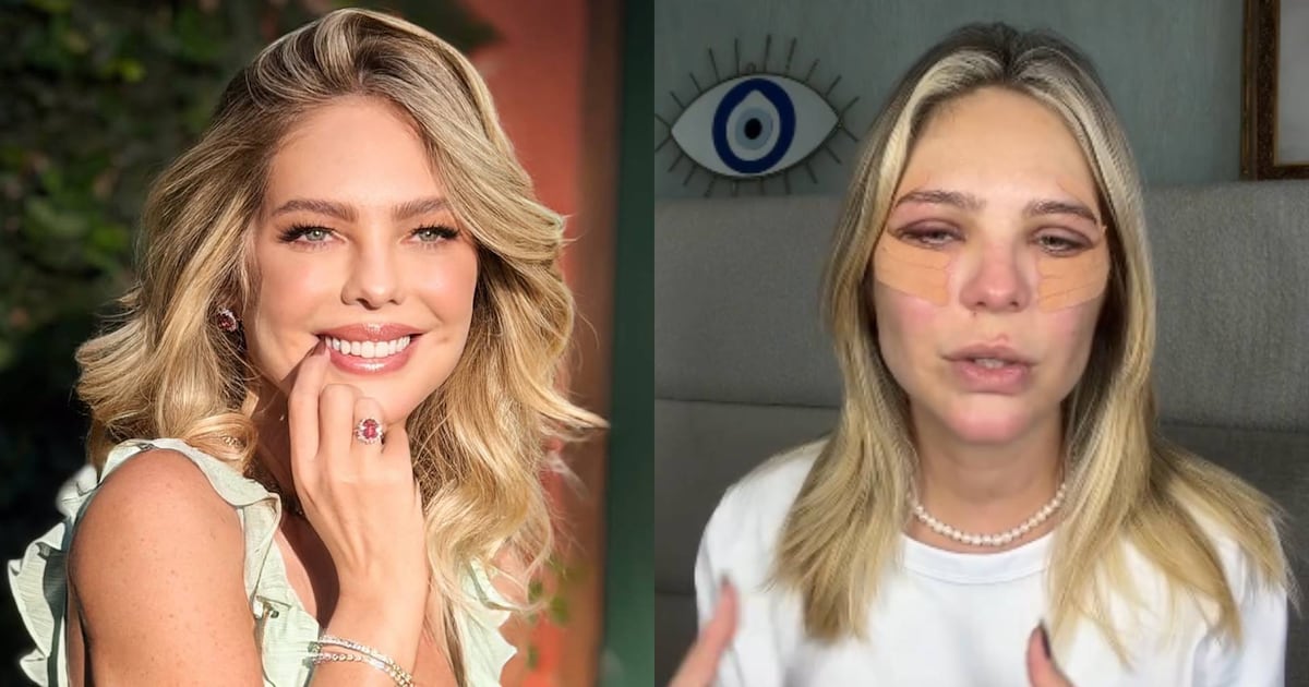 Nora de Leonardo, Thais Gebelein faz cirurgia no rosto e mostra evolução da recuperação