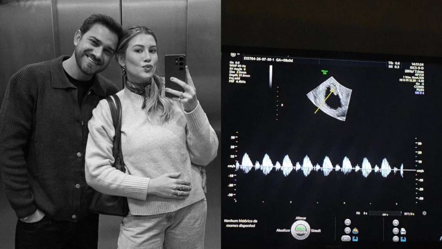 Em uma publica&ccedil;&atilde;o nas redes sociais, Niina afirmou que n&atilde;o sabia se falaria sobre o assunto ou como abordaria a perda