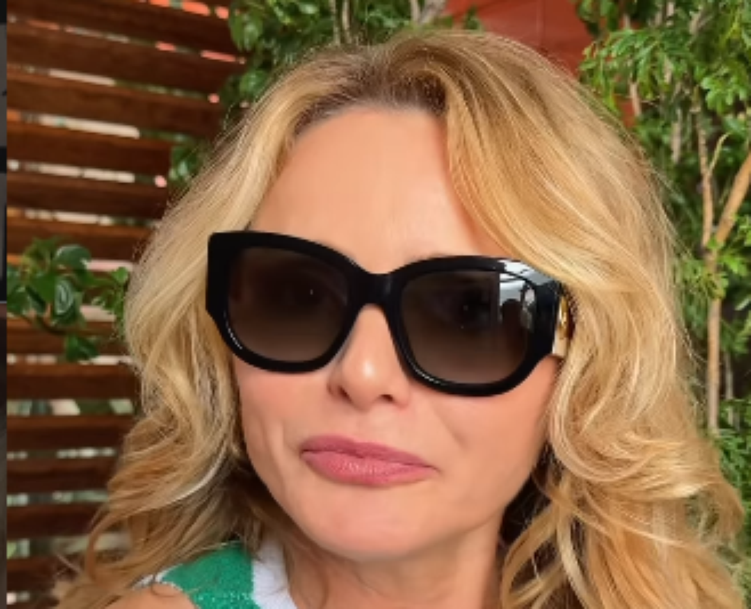 Rita Guedes usa &oacute;culos escuros ap&oacute;s complica&ccedil;&atilde;o cir&uacute;rgica