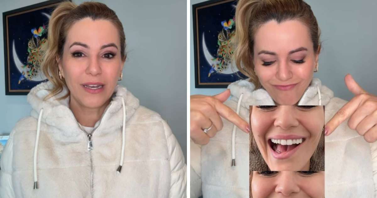 Ex-Panicat Tania Oliveira revela intercorrência em retirada de tumor: 'Meu sorriso ficou comprometido'