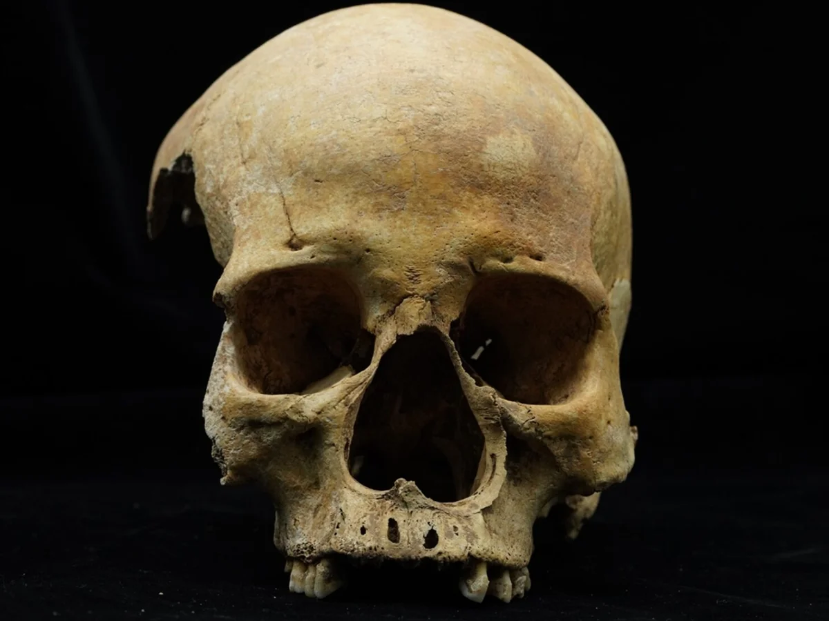 Mulher enterrada de bruços teve nariz amputado há cerca de 700 anos