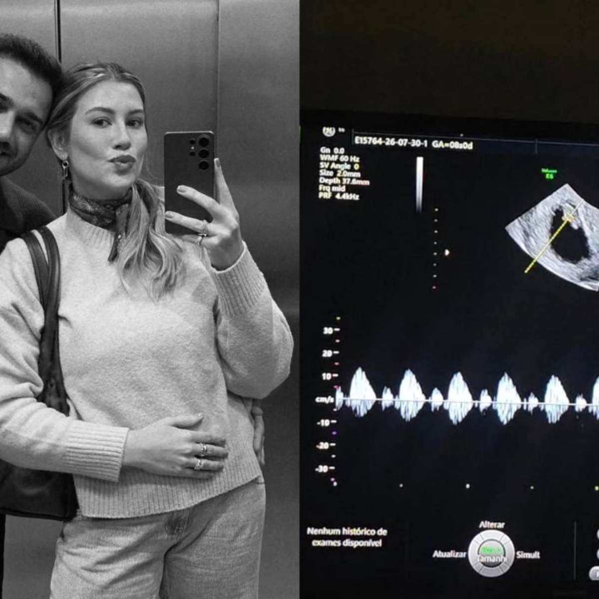 Niina Secrets revela perda de bebê: ‘Dor e uma tristeza no coração’