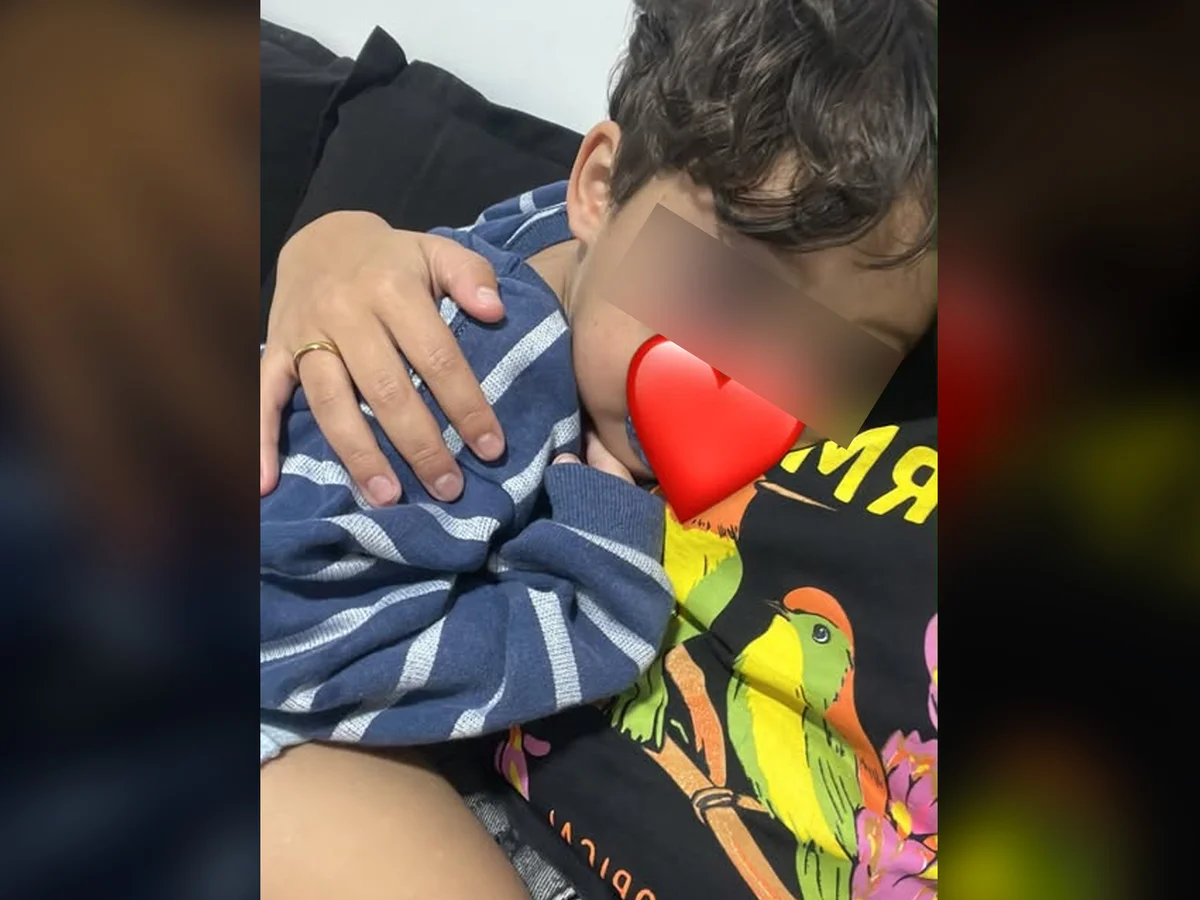 Criança de 3 anos volta para casa com hematomas no rosto após dia na creche
