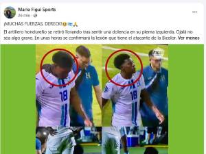 Cansaço, apontam dois e uma preocupação após a dolorosa derrota de Honduras contra Suriname.
