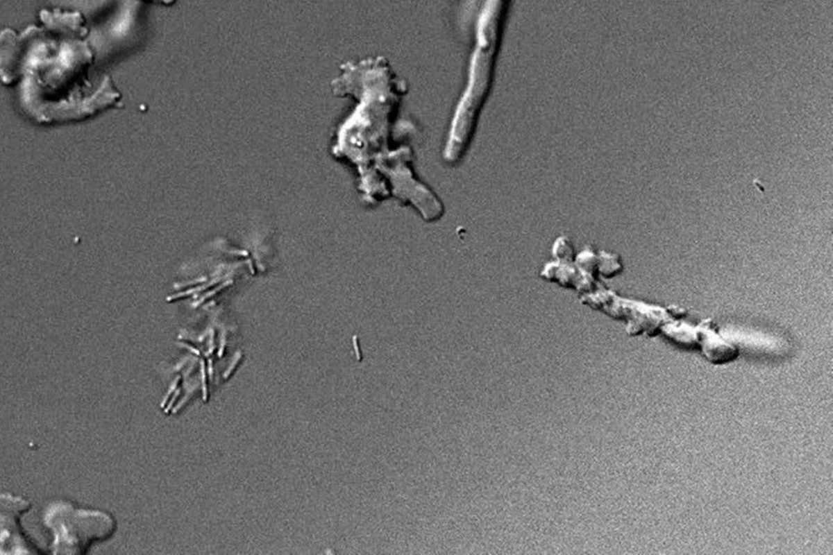 “Ameba de fogo”: cientistas descobrem espécie que sobrevive a 64 °C