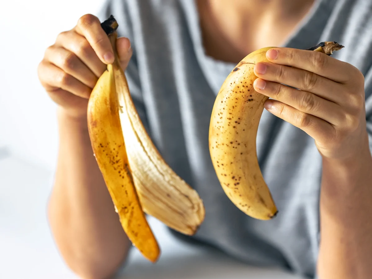 Consumir casca da banana pode regular o intestino e promover mais saciedade
