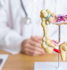 Veja os perigos dos pólipos intestinais Foto: Shutterstock / Saúde em Dia