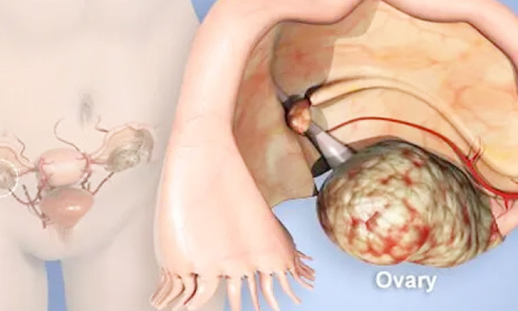 Vendedores de Eenhana enfrentam relocação no final do mês