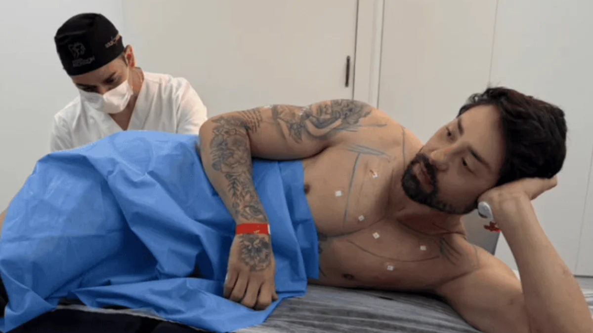 "Cutox": médico explica procedimento anal realizado por Rico Melquiades