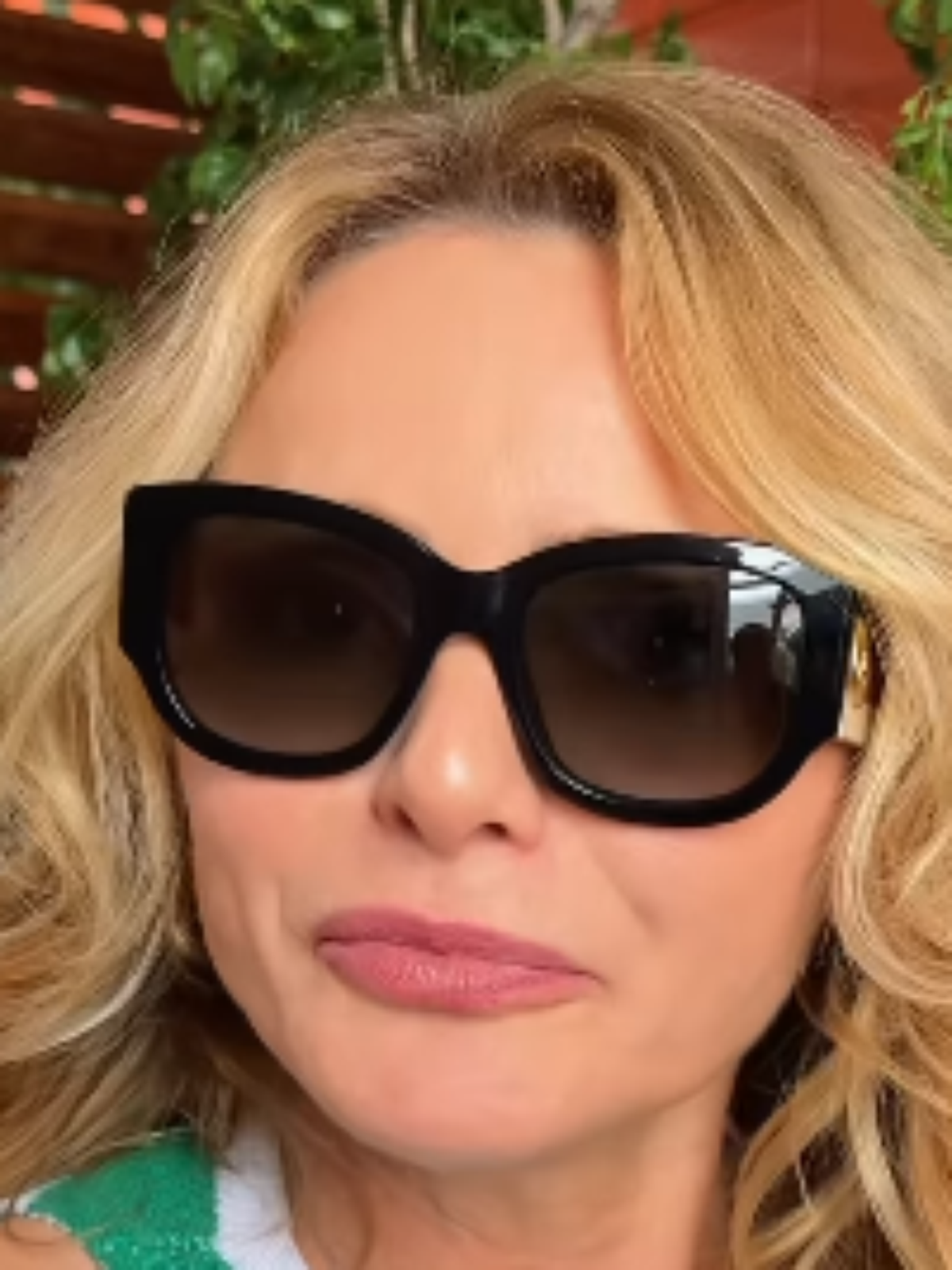 Rita Guedes conta o que aconteceu após blefaroplastia e revela que correu risco de perder a visão
