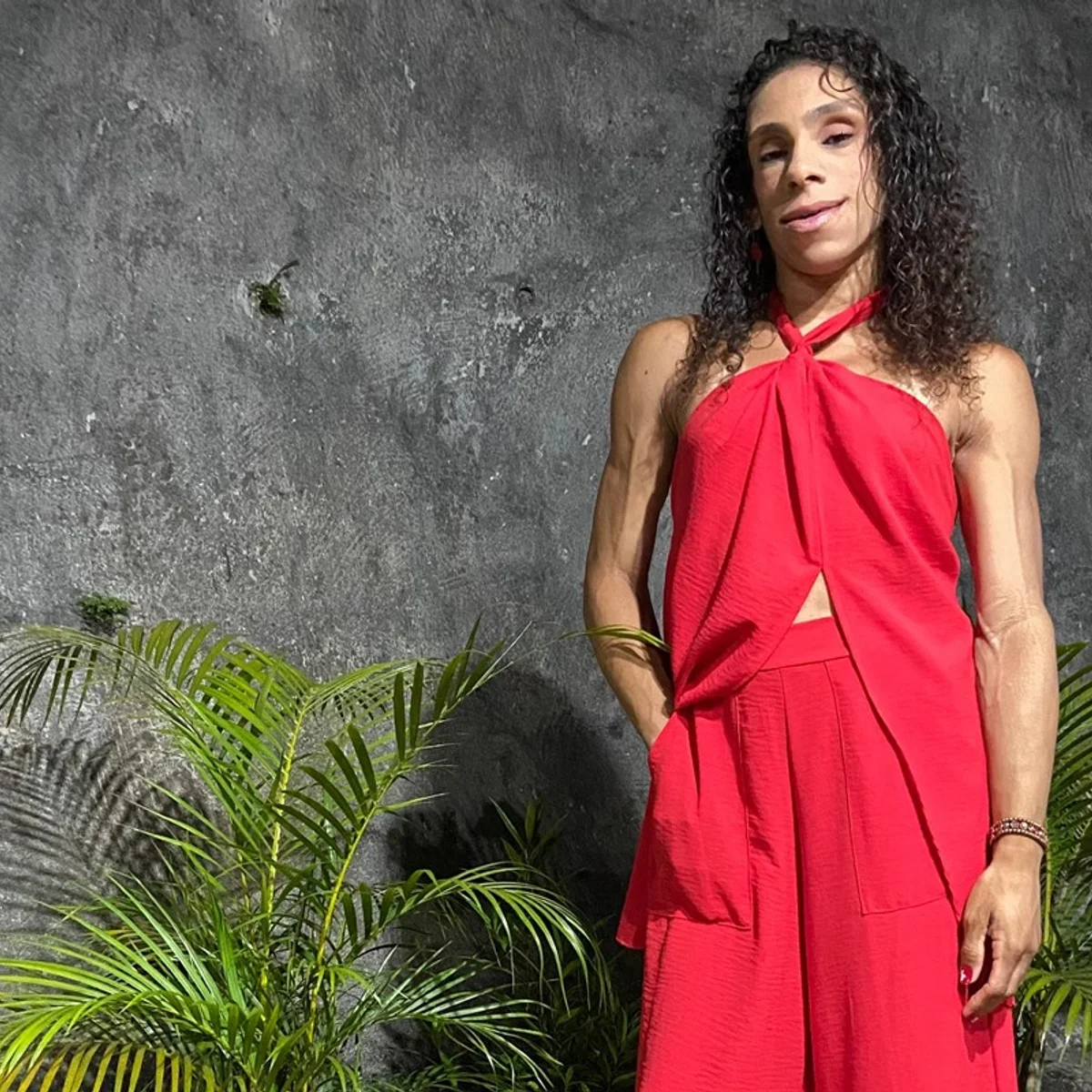 Doença rara faz mulher ter ausência quase total de gordura aparente