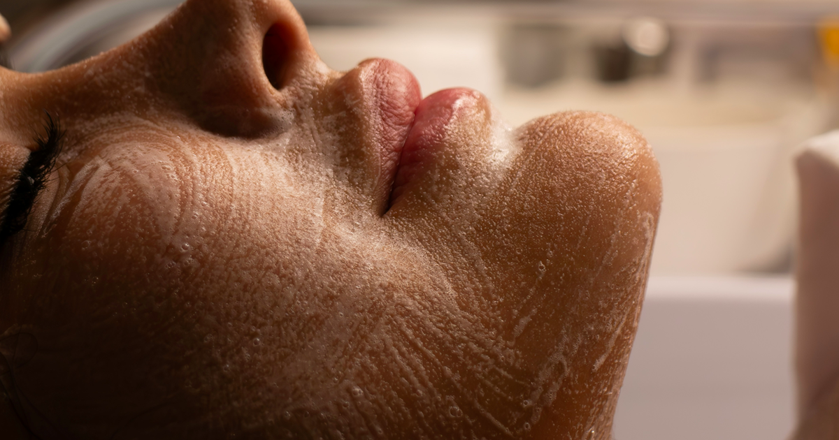 'Dose da beleza': entenda os riscos da nova moda nas redes para o rejuvenescimento