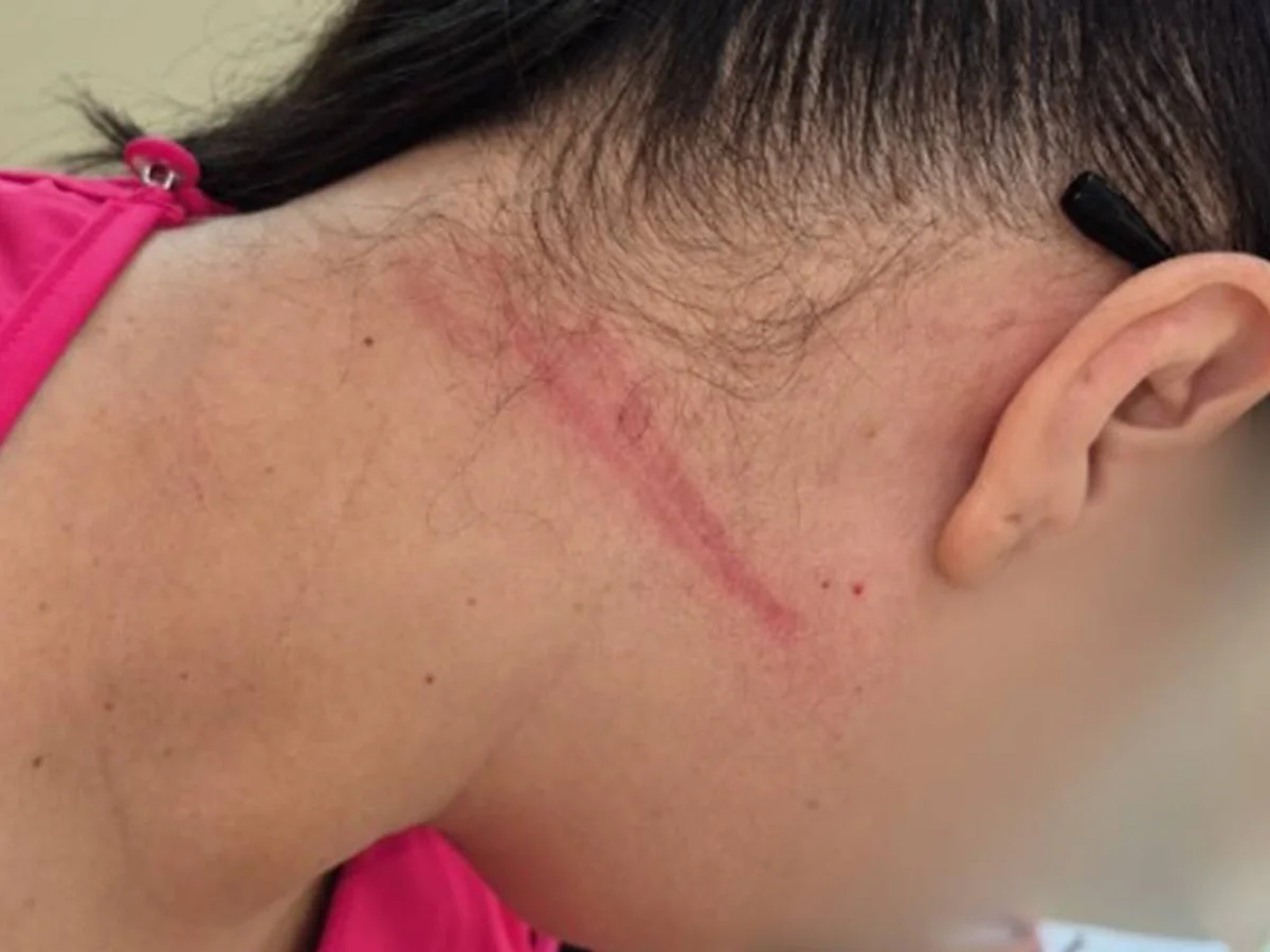 Fotos: técnica de enfermagem enforcada em UPA teve hematomas no pescoço
