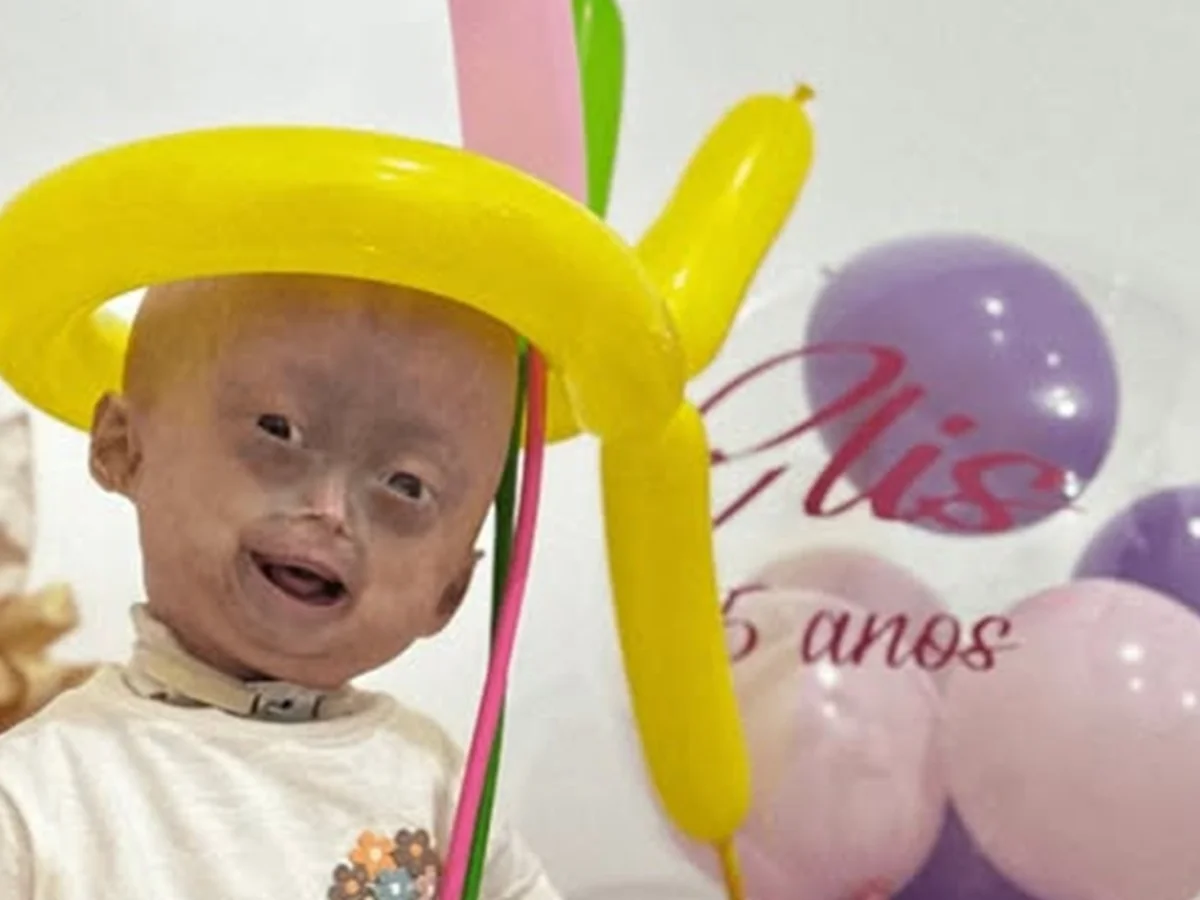 Mãe de Elis, influencer mirim com síndrome rara, lamenta a morte. Veja