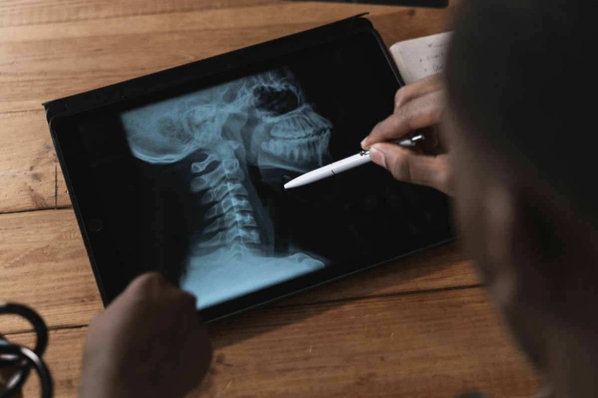 Existe postura ideal? Fisioterapeuta explica como evitar dores na coluna